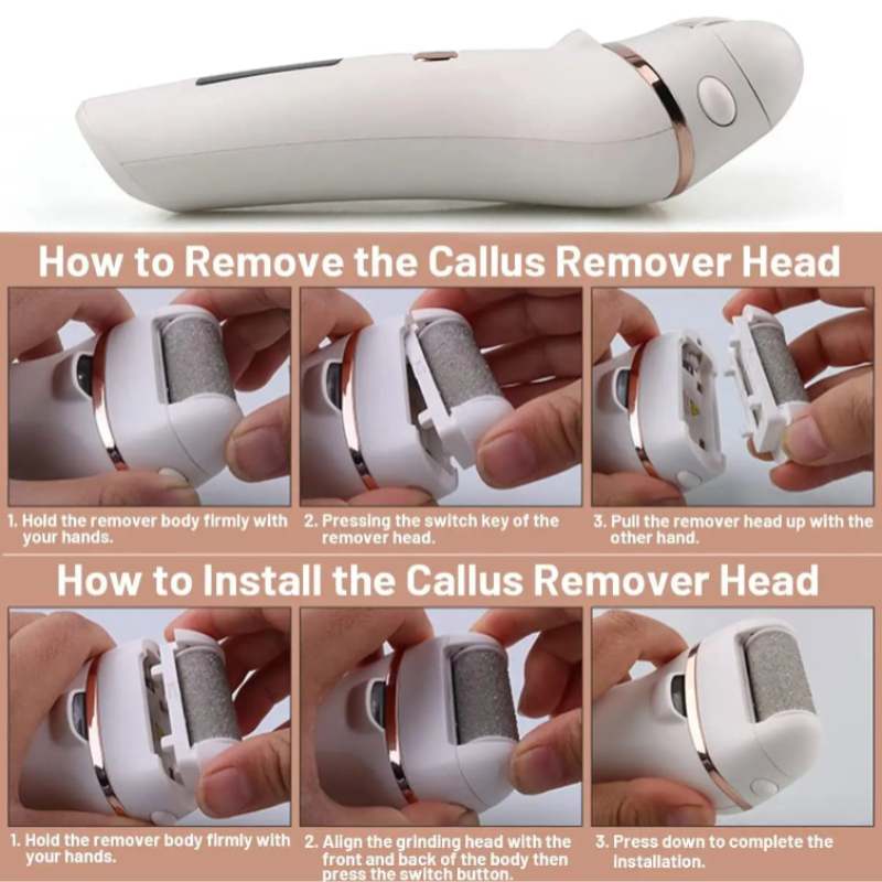 Electric Foot Callus Remover Kit Waterproof USB Rechargeable Great Gift Professional Pedicure Tools